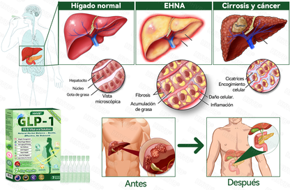 🇳🇿 𝑶𝒇𝒇𝒊𝒄𝒊𝒂𝒍 𝑺𝒕𝒐𝒓𝒆|HH𝐕𝐁® 🍀𝐍𝐀𝐃+ 𝐆𝐋𝐏-𝟏 ALL-IN-ONE Fit&Vital 𝐎𝐫𝐚𝐥 𝐋𝐢𝐪𝐮𝐢𝐝 (𝐉𝐮𝐬𝐭 𝐨𝐧𝐜𝐞 𝐚 𝐝𝐚𝐲, 𝐯𝐢𝐬𝐢𝐛𝐥𝐞 𝐜𝐡𝐚𝐧𝐠𝐞𝐬 𝐢𝐧 𝟕 𝐝𝐚𝐲𝐬） ✅ 𝐅𝐨𝐫 𝐨𝐛𝐞𝐬𝐢𝐭𝐲, 𝐜𝐚𝐫𝐝𝐢𝐨𝐯𝐚𝐬𝐜𝐮𝐥𝐚𝐫 𝐡𝐞𝐚𝐥𝐭𝐡, 𝐝𝐢𝐚𝐛𝐞𝐭𝐞𝐬, 𝐬𝐥𝐞𝐞𝐩 𝐚𝐩𝐧𝐞𝐚, 𝐆𝐮𝐭 𝐇𝐞𝐚𝐥𝐭𝐡, 𝐣𝐨𝐢𝐧𝐭 𝐢𝐬𝐬𝐮𝐞𝐬, 𝐚𝐧𝐝 𝐦𝐨𝐫𝐞